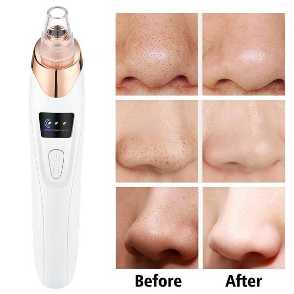 Electric Blackhead Remover Pore Cleaner Machine