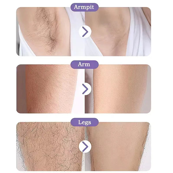 Crystal Physical Painless Hair Removal