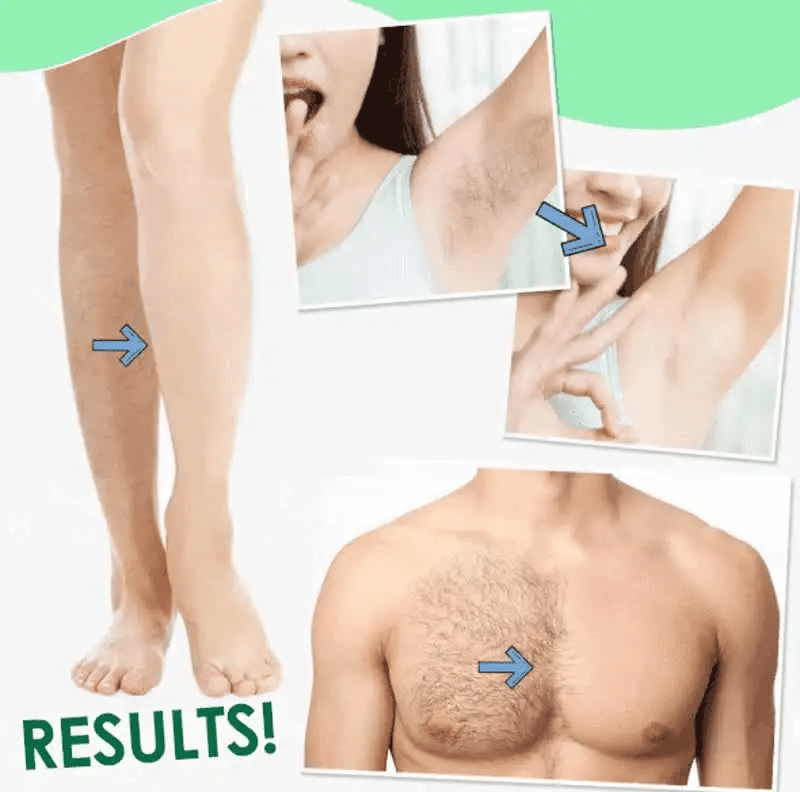 Sydonic Forever-Smooth Hair Removal
